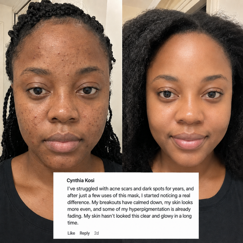 SleepPeel™ Collagen Night Wrapping Mask